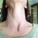 My neck is SUPER smooth, soft, and pigment-free.