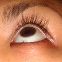 Week 18 Latisse