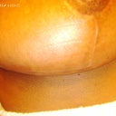 78 DAYS POST OP