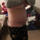 3 wk po