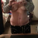 3 wk po