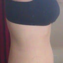 Side view not nearly as puckered as yesterday! Day 21 PO (3 weeks)
