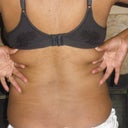 bra-line area
