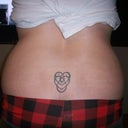 Back side pre-op tummy tuck