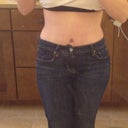 2.5 weeks postop. My jeans!