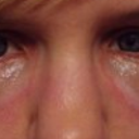 3 Hrs after procedure