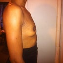 This is side view of me before implants