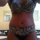 2 weeks post op