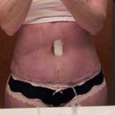 Five day po.  Can not believe this is me!