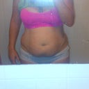 Front view of the one thing that has had me hiding and wearing sweat shirts in the summer>>> last day with this 'mangled mess :)
