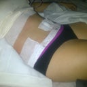 Post op day one!!!  Such a change