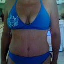 trying on a bikini.  Can I wear one?  or is the scar too noticeable??