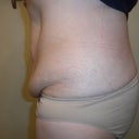 Left side