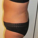 8 weeks side