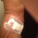 Post Op Day 1