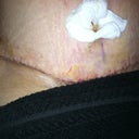 My belley button I was having a real had time with... In am posting pics so you all will know you are not gonna die