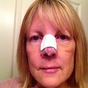 Day6 Christmas Eve. Went out shopping. It's amazing how many women know exactly what you had done....because...they had it done too!!