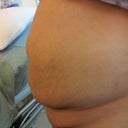 Before Side View