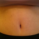 Close up of my BB (5 weeks post op)
