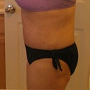 side profile. still swollen at 5 weeks post op (I'll take the swelling over my old belly any day!)