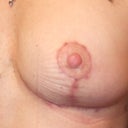 the compression bra left little ridges indented on my skin...I just took it off for the picture. :)