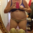 1 month post op.