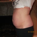 4 days pre-op