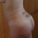 4 weeks post op