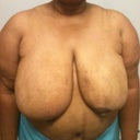 Before surgery