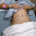 getting ready to roll into the OR