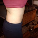 Finally healed!  Maybe I should've done the flanks too... :-/
