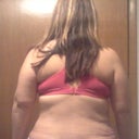 Week 3 - Swollen lower back, both sides