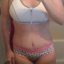 3 weeks PO I feel like my tummy is way more swollen than it should be at this point, this is first thing in the morning and there is NO definition, I saw more in week one than I have seen in the past two weeks.