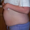 You can really see the hernia above my belly button in this one!