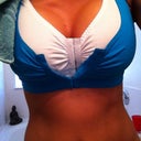 Day after surgery wearing the blue bra I THOUGHT would fit me after surgery.  Im wearing the bra they sent me home in and placing gel ice-packs between the two bras