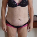My before photos