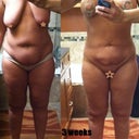 Before and 3 weeks Front