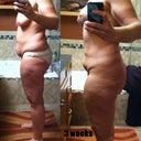 Before and 3 weeks Side