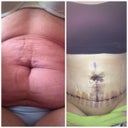 Before and after, OMGoodness!!!