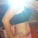 3 weeks post up- still swollen but getting better :)