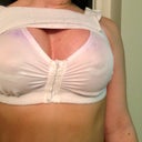 SEXIEST BRA EVER. DAMN GIRL. LOL. TOTALLY JOKING. I HATE THIS THING!!!! Hahaha The purple is marks from surgery. I'm ten days out. :)