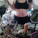 day 13 post op