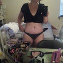 day 10 post op