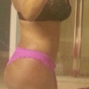 4 months after surgery...liking my overall shape...but would like a little more roundness on the top of my buns