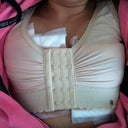 Right after surgery!