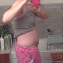 Side 7 days PO I look very swollen and puffy! I hope goes away soon!