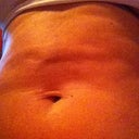 2 wks post op.  Divots and unevenness.