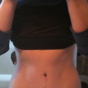 4 weeks post op