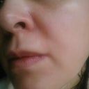as you can see it doesnt look red its pink, no peeling as i exfoliated in the morning and no irritation or pain anymore