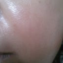 close up on moisturized skin, I went ahead and applied strivectin